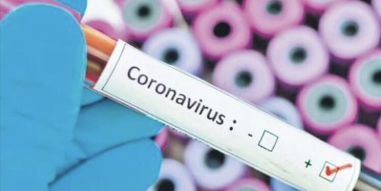 Mali i Zi konfirmon dy rastet e para me koronavirus, njëra në Ulqin, tjetra në Podgoricë