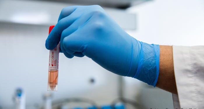 Shërohen dy persona të infektuar me COVID-19, nga komuna e Tuzit