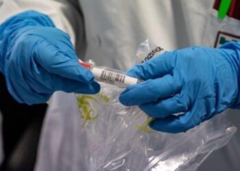 Edhe 59 raste të reja me koronavirus në Mal të Zi