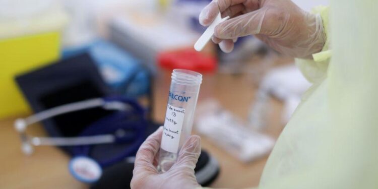 Tuz-Malësi, shkon në 52 numri i të infektuarve me COVID-19