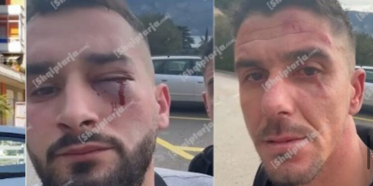 Tre shqiptarë rrihen barbarisht nga një grup personash në Mal të Zi
